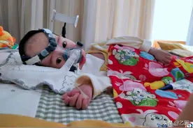 两岁男童患SMA，全身只有眼睛手指能动，器官退化瘦成“骷髅架”图片