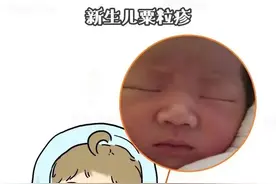 宝宝脸上的白色颗粒是什么？新手爸妈早知道图片