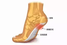 出行、运动后足跟痛？别怕，教你几个动作缓解预防它图片