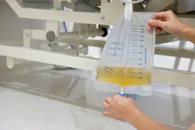 尿液有泡沫说明肾有问题？医生：不一定，这些因素也会导致泡沫尿图片