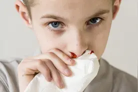 孩子经常流鼻血，是因为干燥还是患上白血病？这才是真相图片