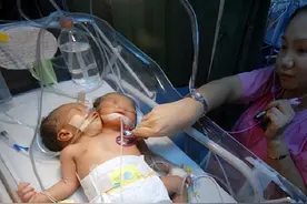 13年前，四川孕妇生下“双头女婴”，今孩子已离世，她和丈夫怎样图片