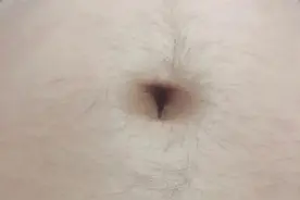 怀孕身体长毛的原因？图片