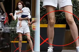 林志玲携“混血”儿子现身！瘦得吓人腿淤青明显，疑似被欺负？图片