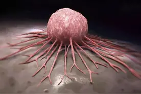 良性肿瘤、恶性肿瘤，如何进行区分？图片