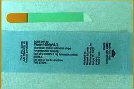 猫眼睛溃疡：简单病征的治疗方案图片