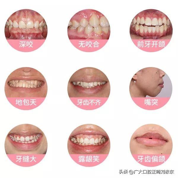 ҽرǿݽ⼸һҪע⣡