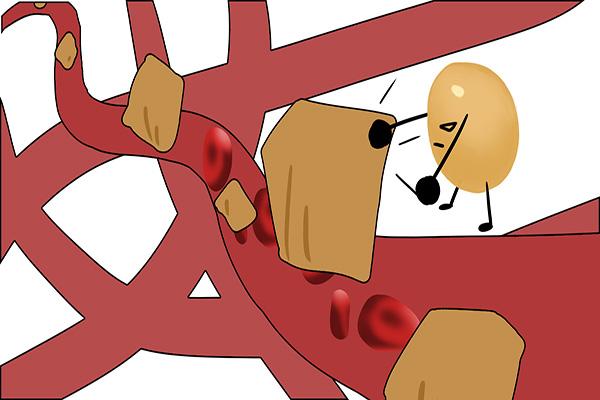 餐桌上的发酵食品，是心血管的“祸根”，还是“良药”？揭晓真相