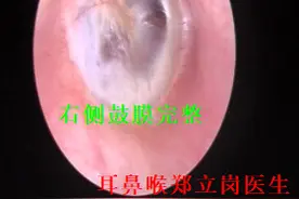 助听器，还是来禅医耳鼻喉医学验配可信图片