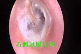助听器，还是来禅医耳鼻喉医学验配可信图片