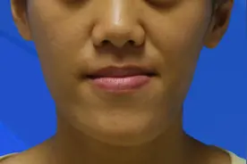 导致“大小脸”的五大因素，第一种最为常见图片