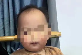 小儿呼吸道中的“不速之客”图片