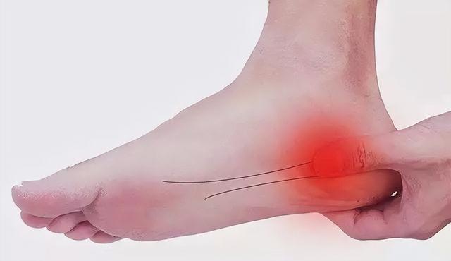 脚走路太多酸痛怎么办
