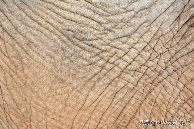 去鸡皮蛇皮鱼鳞皮肤的