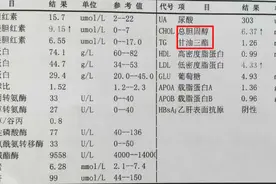 傻傻分不清！脂肪、胆固醇都是什么？这篇文章告诉你答案图片