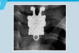 这些东西都能塞进身体里？就离谱图片