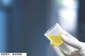 尿液发黄、一喝水就想上厕所？身体在向你“报告”这几件事图片