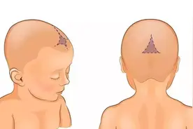 摸了新生宝宝的头顶，会让娃变傻？保护宝宝囟门有2件事不能做图片