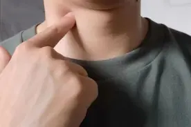 医生让我住院，说我得了大病图片