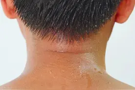 脾湿头出汗，肝湿大腿根出汗，肾湿浑身出汗，养好肝脾肾调出汗！图片