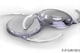 7. 白内障 之六： 白内障手术后如何用药？何时复查？图片