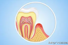 牙龈发痒是怎么回事？图片