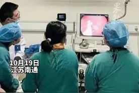 男童吞103颗钢珠医生1小时取出92颗，医生：第一次见吞下这么多的图片