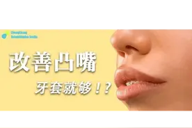 侧颜杀手 「 突嘴」，只能通过牙套矫正吗？图片