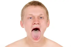 舌头疼痛，食不下咽！这小小的“溃疡”竟是一种罕见癌图片