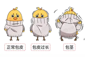 为啥很多女性劝男人割包皮？哪些人要割？别羞于了解图片