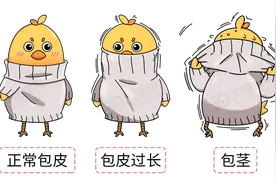 为啥很多女性劝男人割包皮？哪些人要割？别羞于了解图片