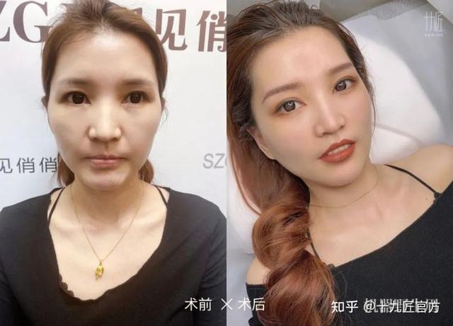 雾眉，线条眉和丝雾眉有什么区别呢？
