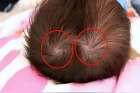 孩子头上的“旋”代表什么？与智商和性格有关吗？今天告诉你答案图片