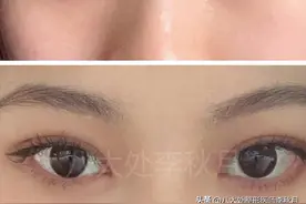 双眼皮术后怎么护理，这4点要牢记！图片