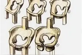 冉冉科普｜骨盆前倾与后倾的矫正思路图片