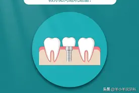 种植牙齿去哪里，要怎么选？图片