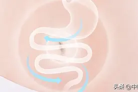 腹痛、腹泻、黏液脓血便，炎症性肠病的饮食指南，赶紧收藏起来图片