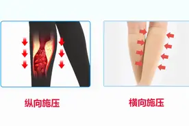 医用弹力袜/静脉曲张袜如何缓解治疗静脉曲张？图片