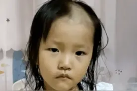3岁女孩玩理发器把自己剃成“地中海”，妈妈哭笑不得：买了帽子和发卡给她遮住图片