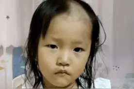 3岁女孩玩理发器把自己剃成“地中海”，妈妈哭笑不得：买了帽子和发卡给她遮住图片