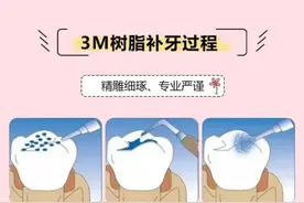 补牙后牙酸痛不一定是没补好，可能是这些原因图片