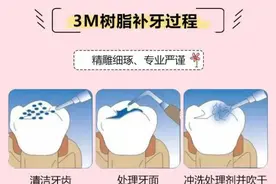 补牙后牙酸痛不一定是没补好，可能是这些原因图片