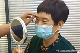 60岁阿姨走上医美手术台，祛眼袋+重睑去皮后，像变了一个人图片