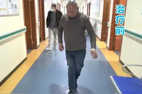 惊！每天一斤酒，福州大叔喝出“剪刀脚”图片