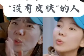 张婉婷——一个“没有皮肤”的人！图片