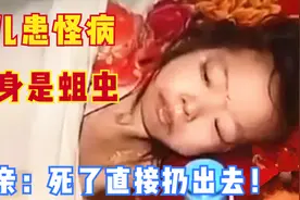 10岁女孩身上长满蛆虫生命垂危，父亲却拒不回家：死了直接扔出去图片