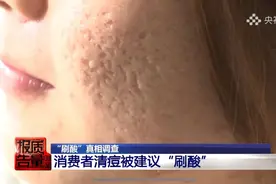 火遍全网的“刷酸”真的那么神奇？你该知道真相了！图片