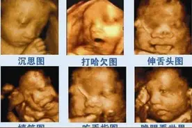 做四维的最佳时间是多少周？最新《孕前和孕期保健指南》告诉孕妈图片