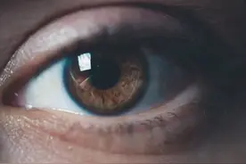 高度近视会遗传吗？该怎么选择适合的运动方式呢？图片