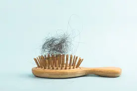 脱发科普：5种常见脱发类型及男女脱发区别，今天一次性讲清楚图片